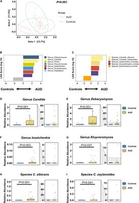 Dynamic Changes of the Fungal Microbiome in Alcohol Use Disorder